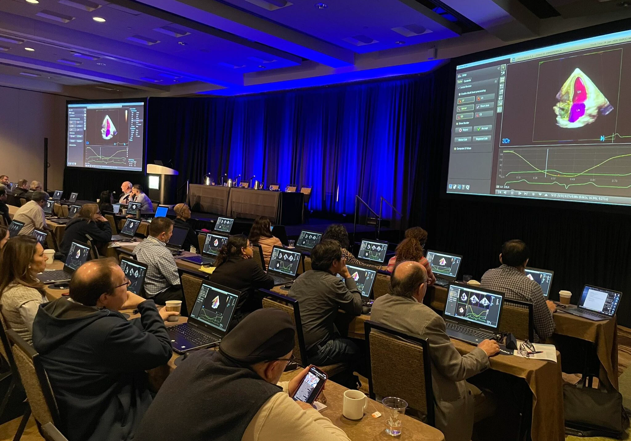 American Society of Echocardiography - ASE